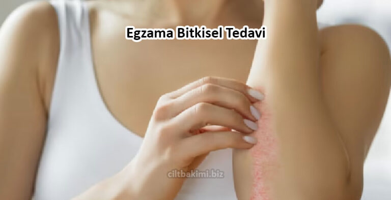 Egzama Nedir Egzama Nas L Ge Er Cilt Bak M