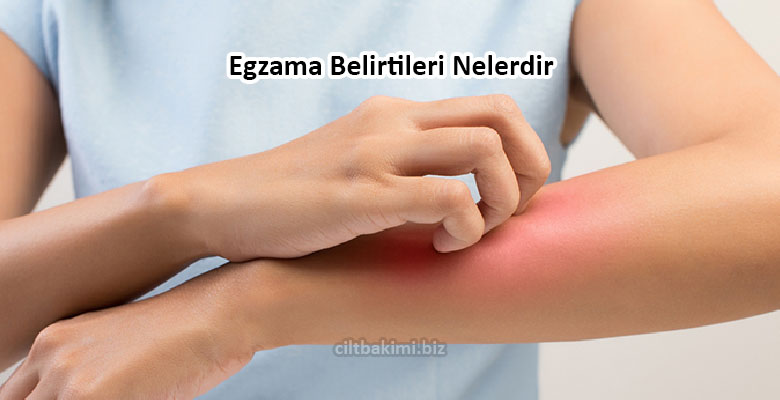 Egzama Nedir Egzama Nasıl Geçer